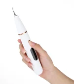 კბილების გაწმენდა ქვებისგან