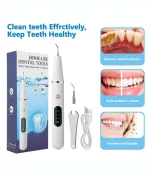 კბილების გაწმენდა სკალერის აპარატით